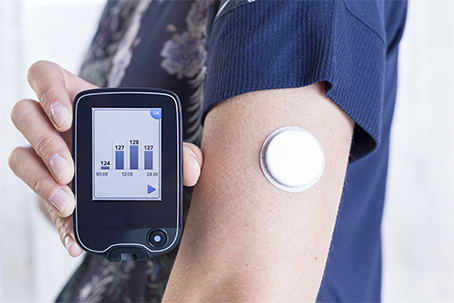 Continuous Glucose Monitor (CGM)